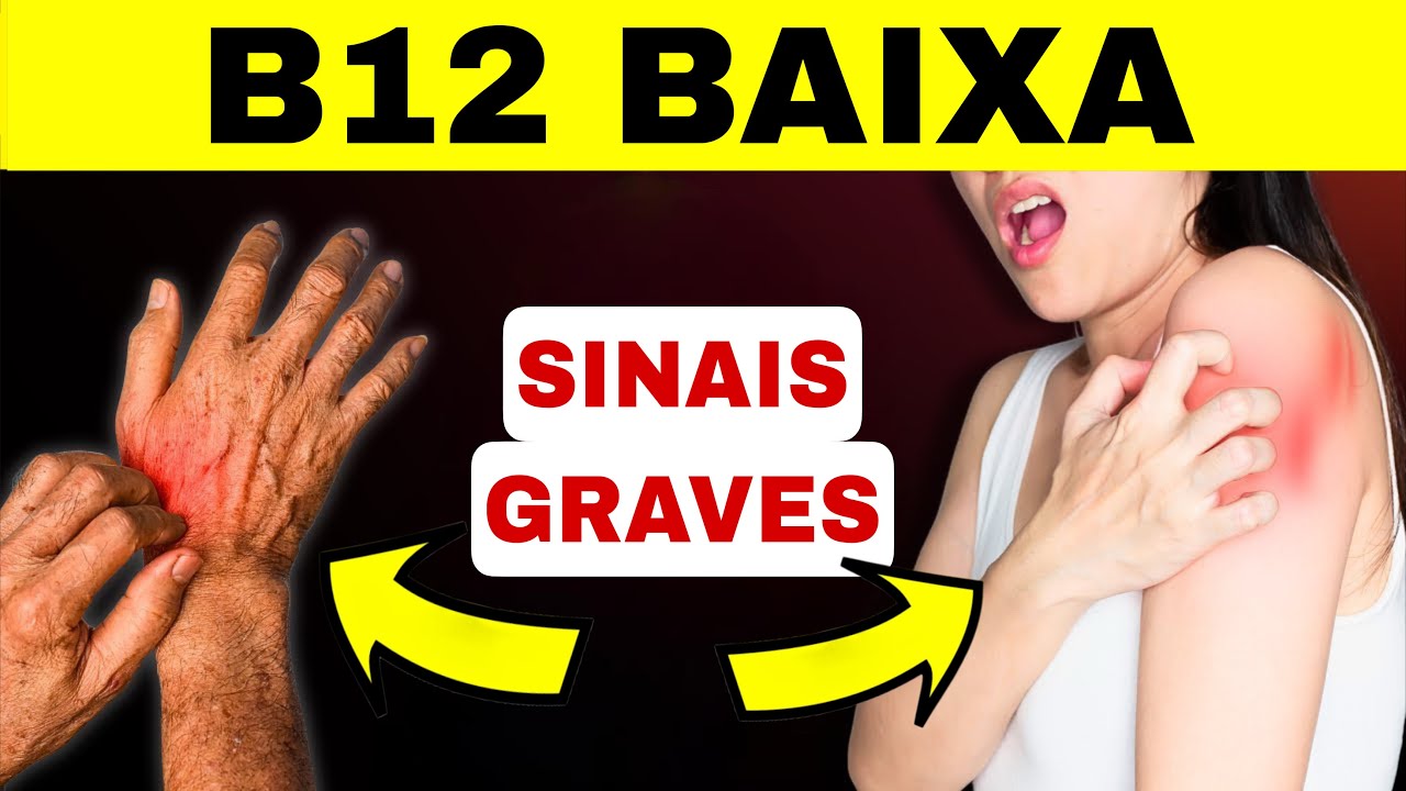 9 SINAIS URGENTES de FALTA de VITAMINA B12 (Nunca Ignore Isso)