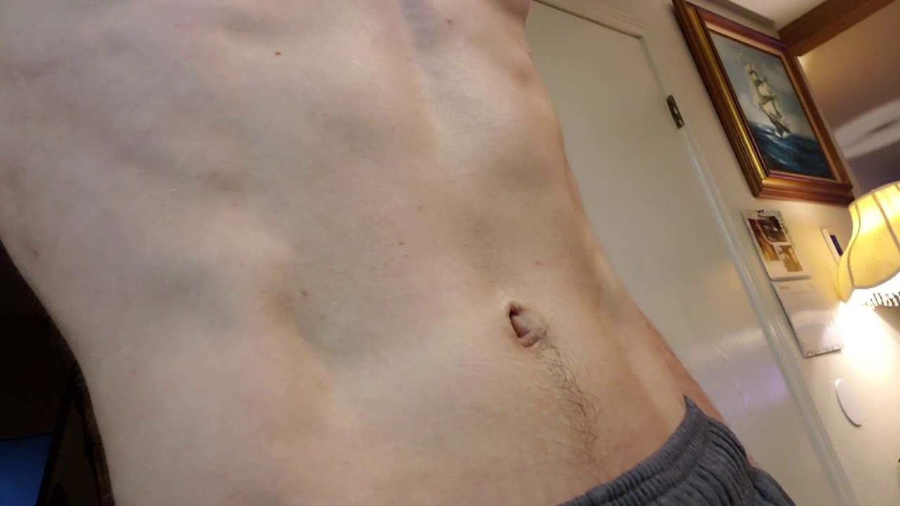 Floating rib clicking and causing full rib pain
