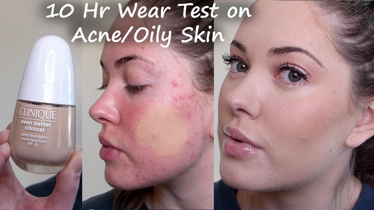 New Clinique Even Better Clinical Serum Foundation WEAR TEST on acne prone & oily skin (cn 08 linen)