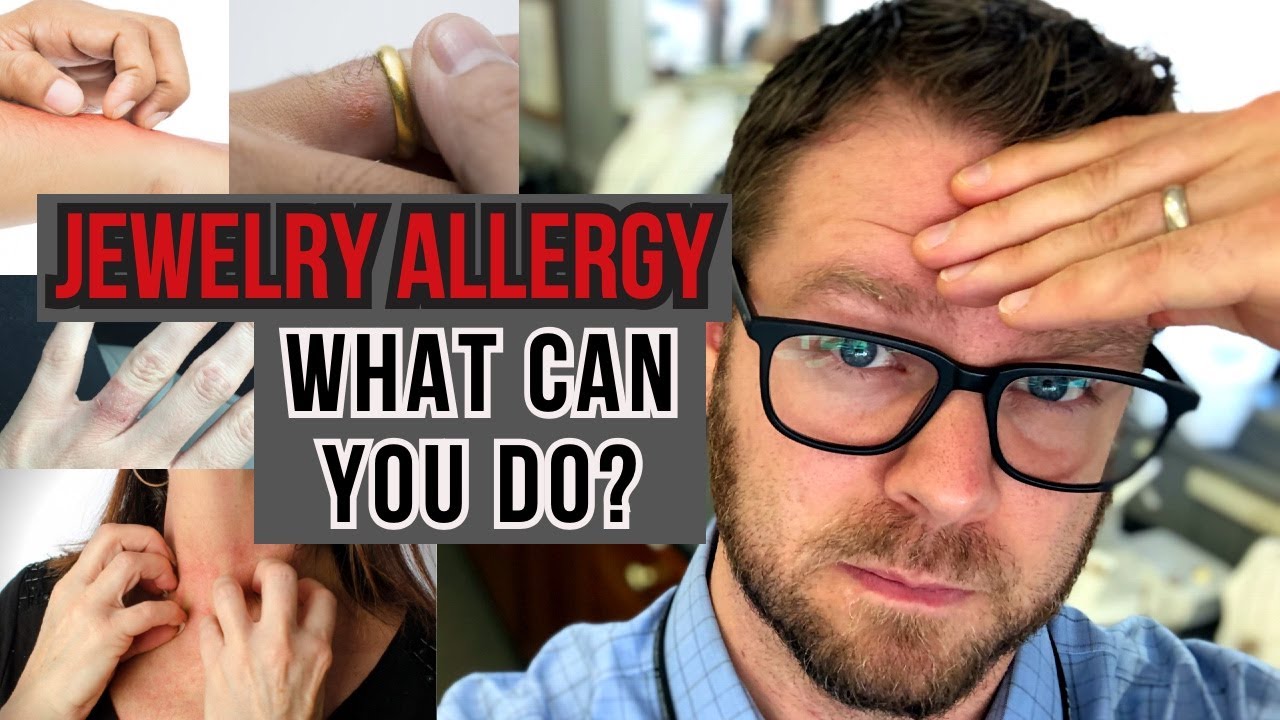 Jewelry and Allergies: What to do when you have an allergic reaction to your jewelry-ring cause rash
