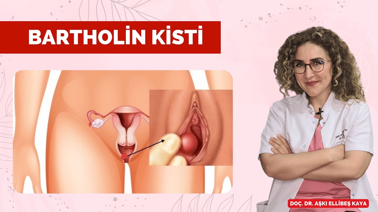 Bartholin Kisti - Doç. Dr. Aşkı Ellibeş Kaya
