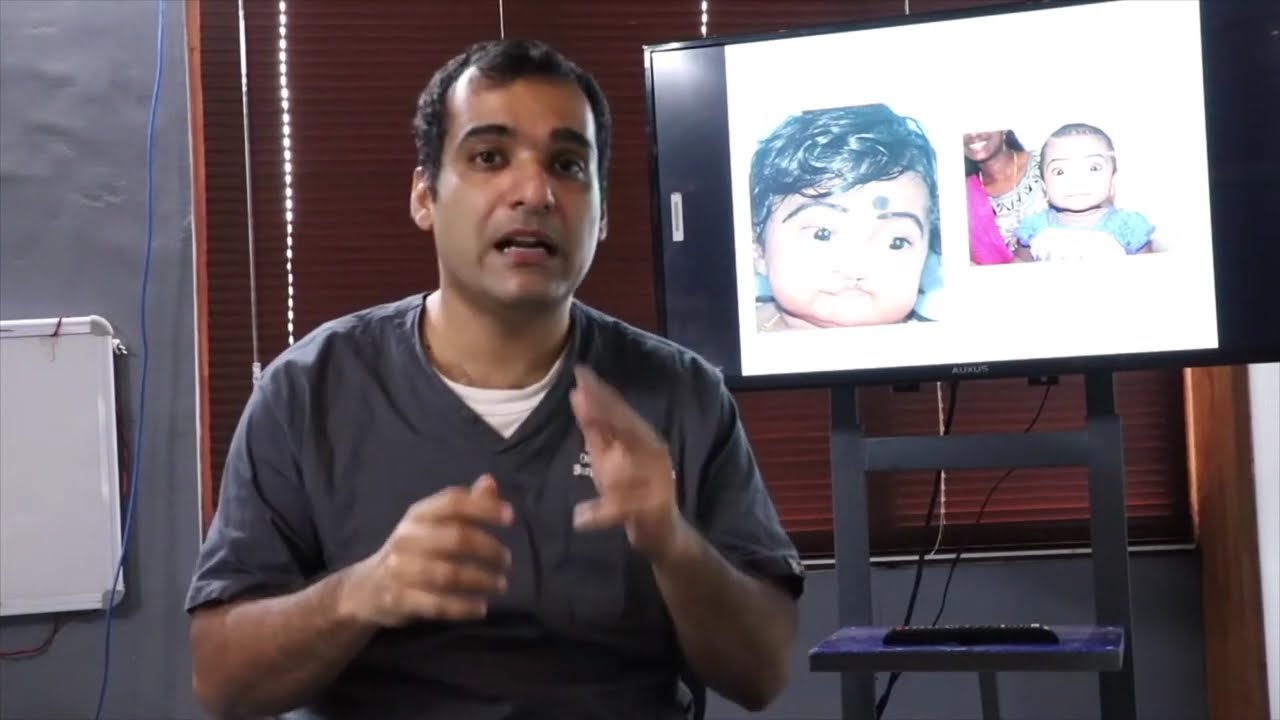 Precautions after cleft palate surgery- explained by Dr Mathew