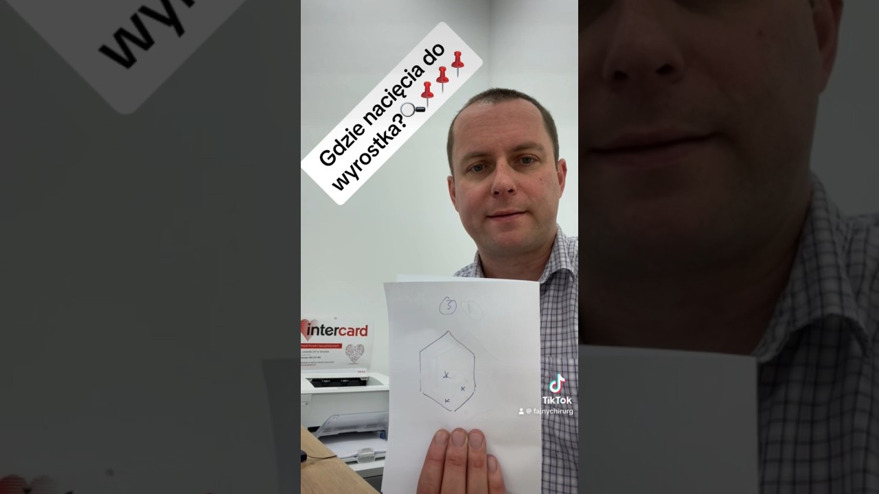 Wasze pytania: Gdzie nacięcia do wyrostka?🔍📌📌📌