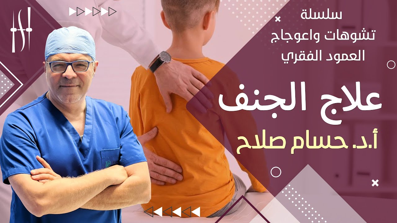الحلقة الأهم لكل مرضي الجنف .. ما هو علاج الجنف؟