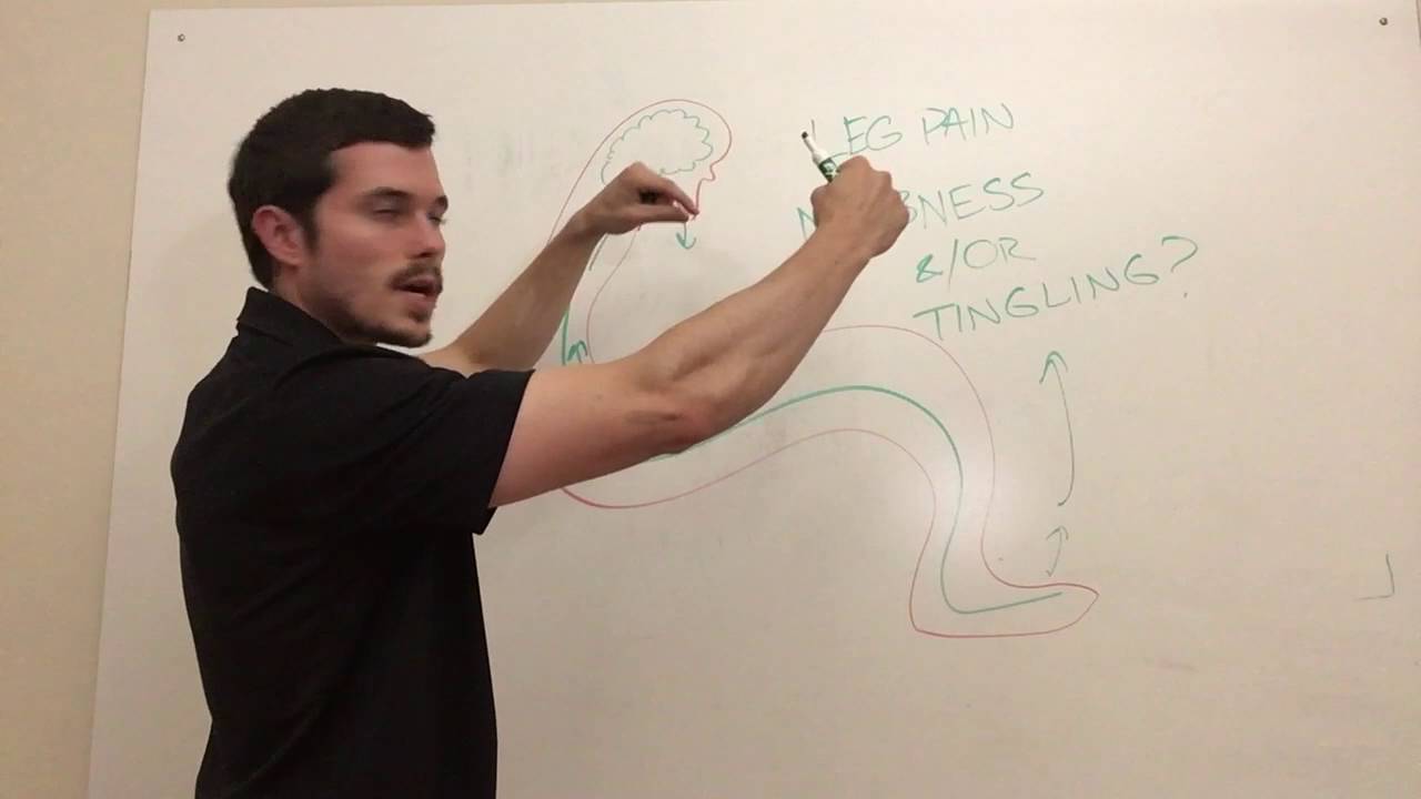 Sciatica Self Test Explained