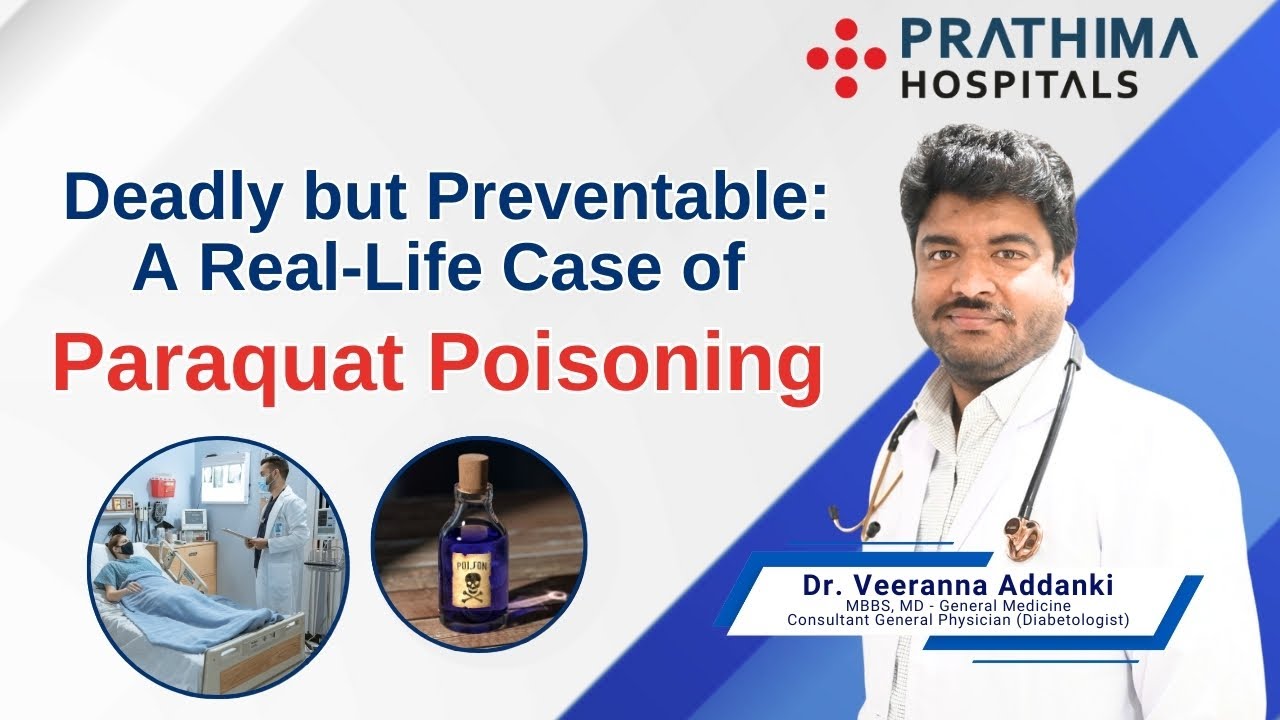Rare Paraquat Poisoning Survival Case | Explained by Dr. Veeranna || Prathima Hospitals- KPHB