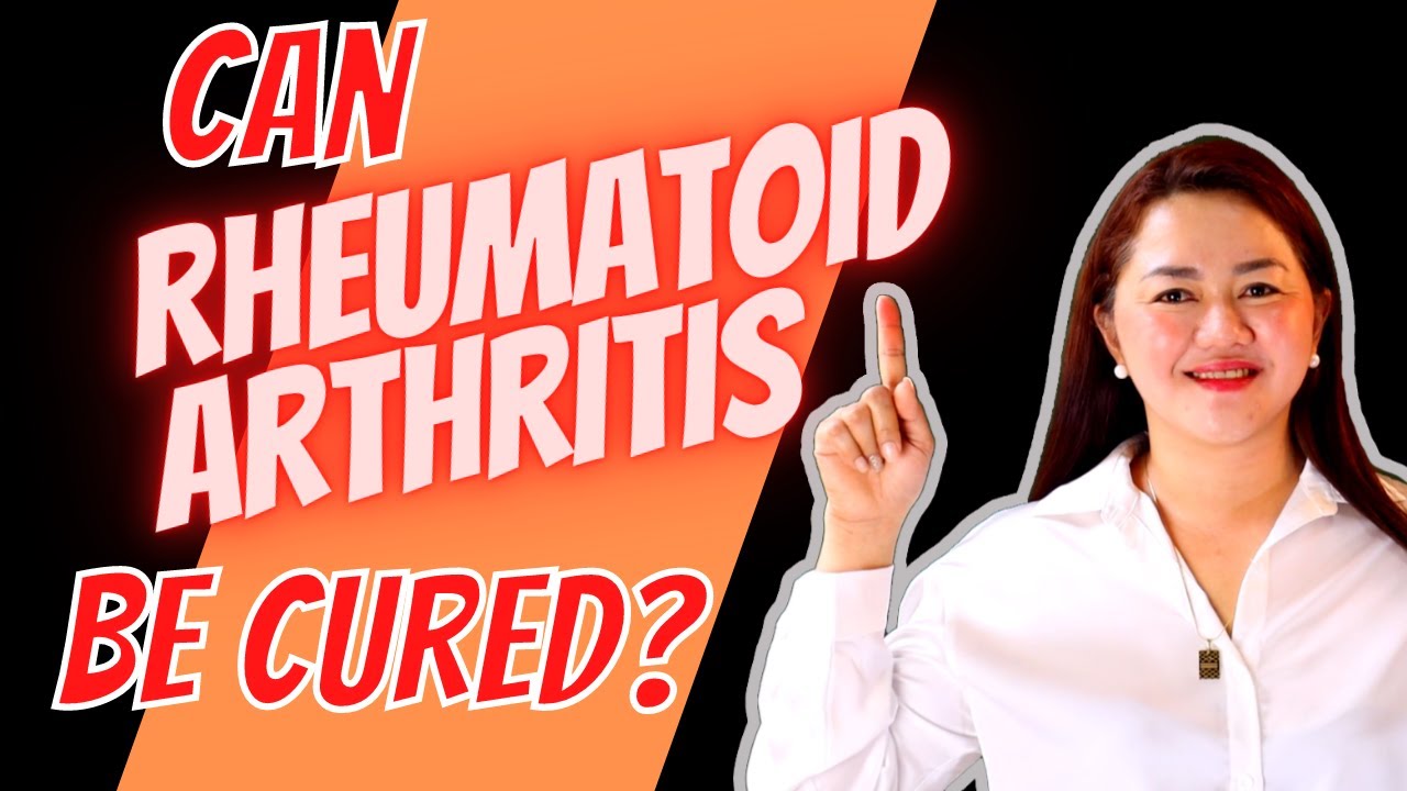 What are Your Treatment Options for Rheumatoid Arthritis | Doc Cherry