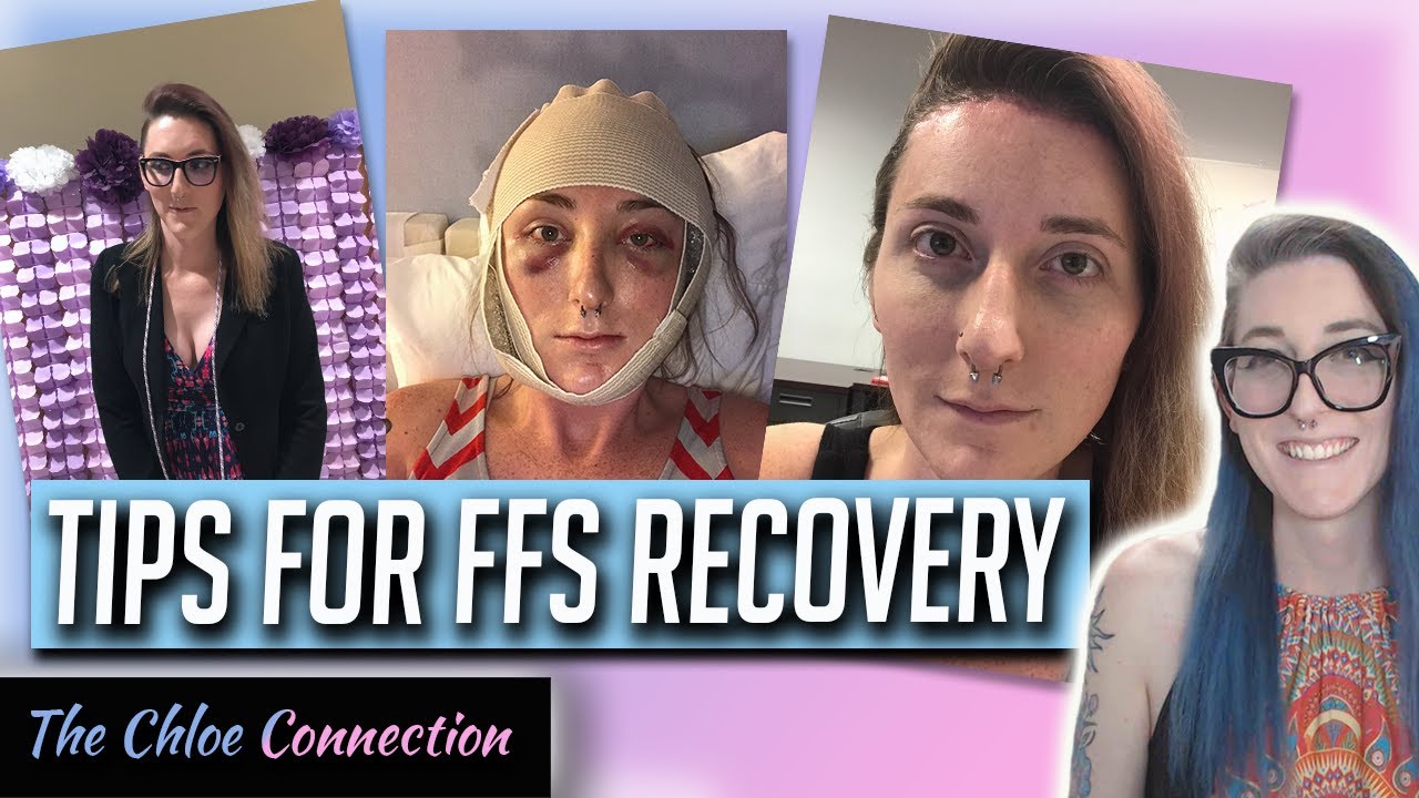 Helpful Tips for Facial Feminization Surgery (FFS) Recovery | MTF Nonbinary Transgender Transition