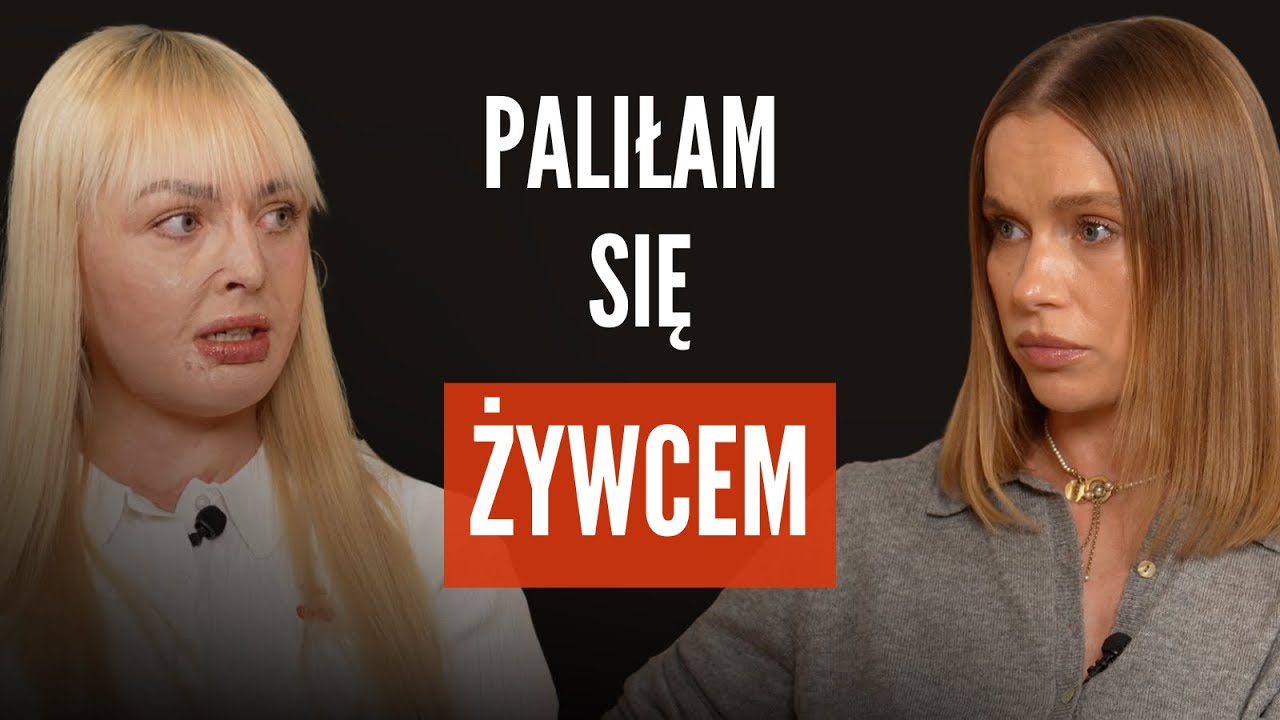 Maja Kuczyńska: paliła się żywcem, dostała nowe życie.