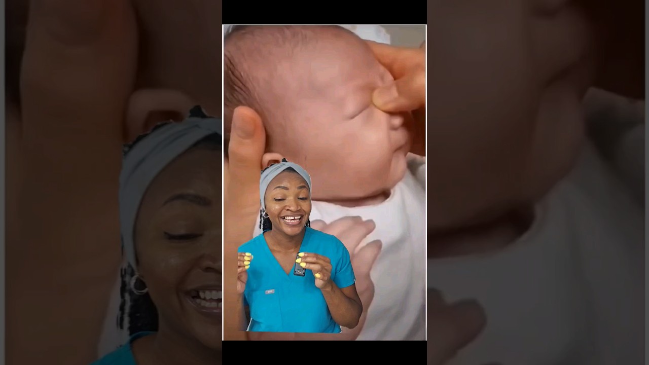Doctor explains crigler massage to help crusted eyes in babies #blockedtearduct #newborns