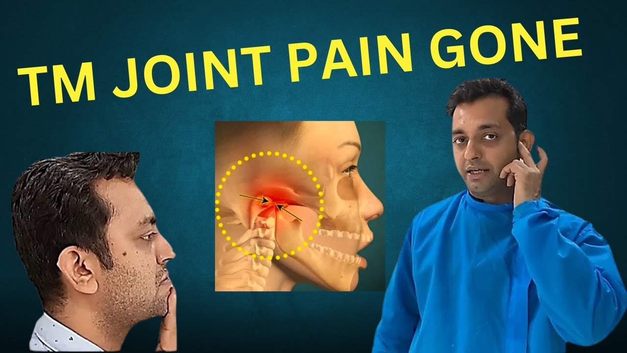 Tm joint pain gone - exercise for tm joint pain relief  | Dr Rohan Virani