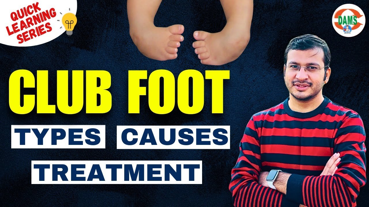 Club Foot: Types Causes, Treatment | Quick Learning Series by Siddharth Sir | DAMS Nursing