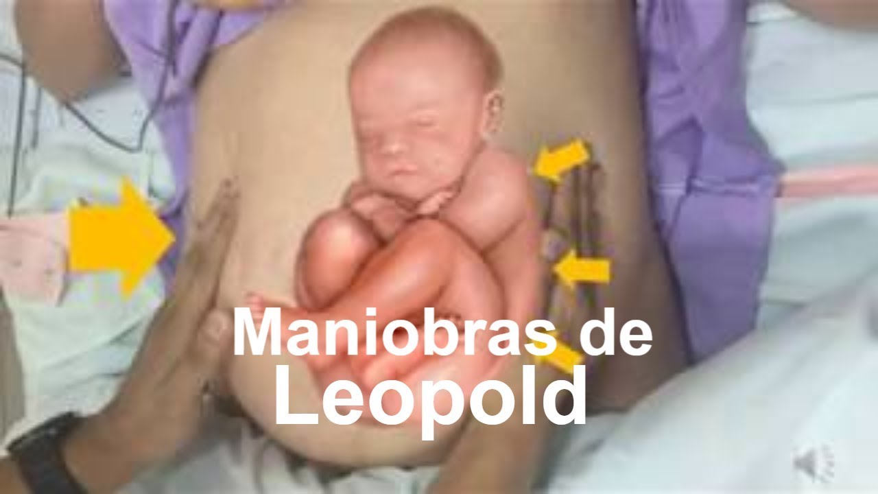MANIOBRAS DE LEOPOLD ▷ Técnica de las Maniobras de Leopold