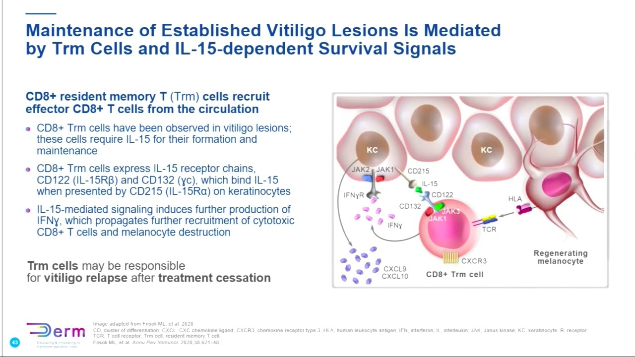 Controversies & Challenges in the Pathophysiology of Vitiligo​Interview and audience Q&A​