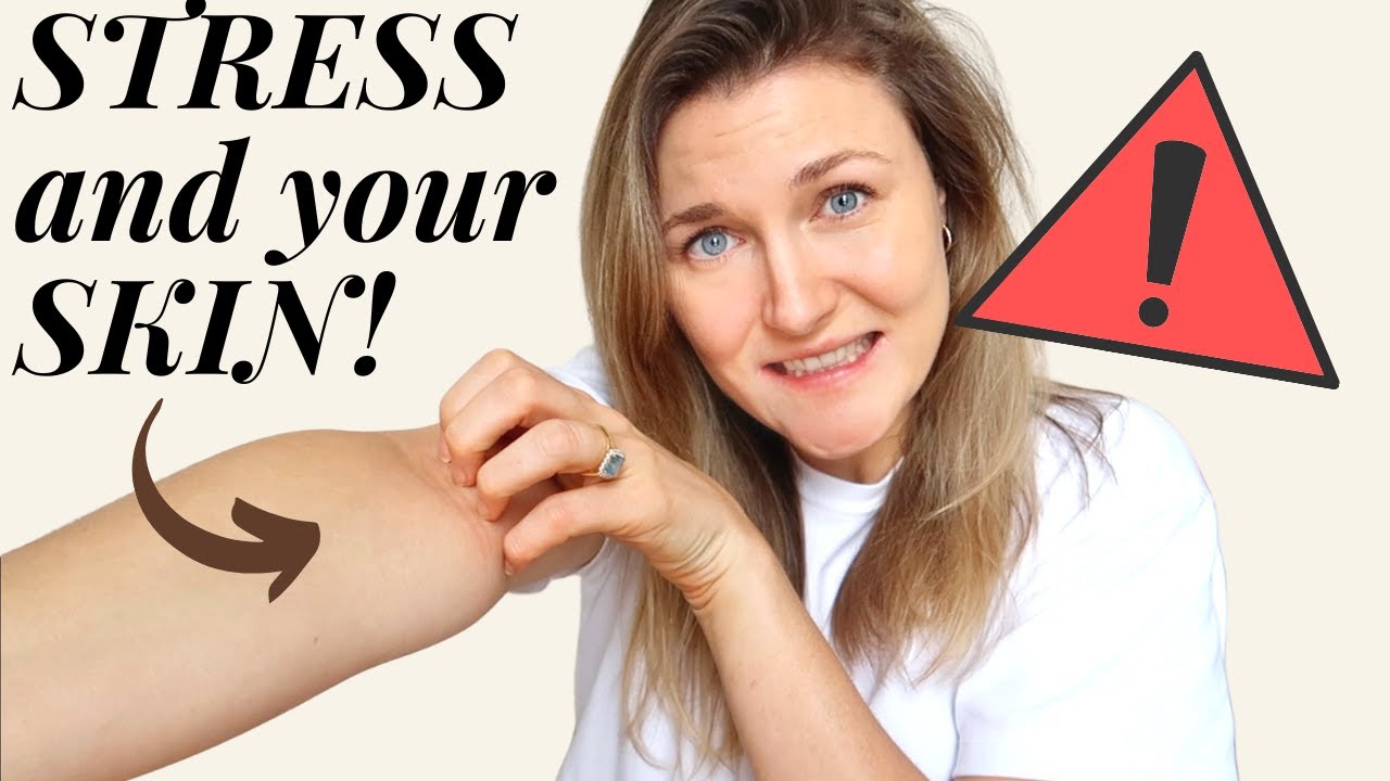 How STRESS affects your SKIN | skin issues caused by stress | mind skin connection