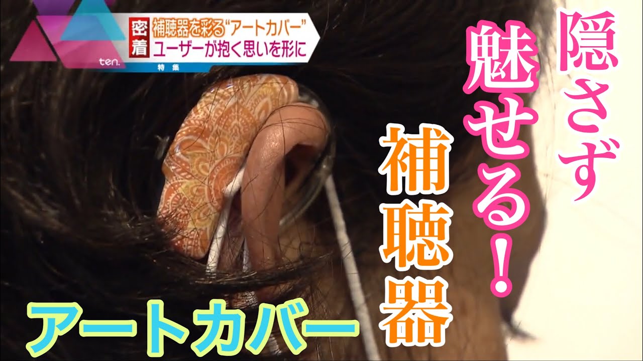 補聴器を彩る“アートカバー”　隠さず「魅せる」