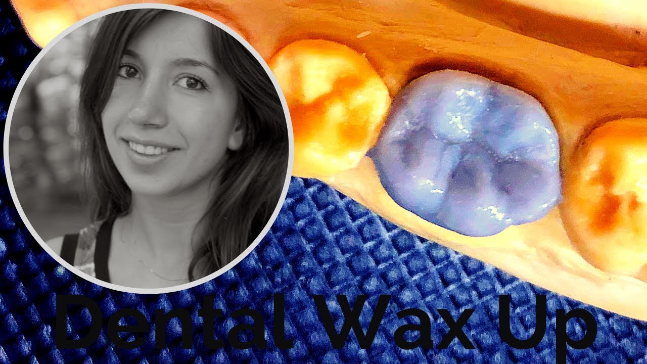 Dental Wax Up Molar 36 - High Speed [Waxup Tutorial]