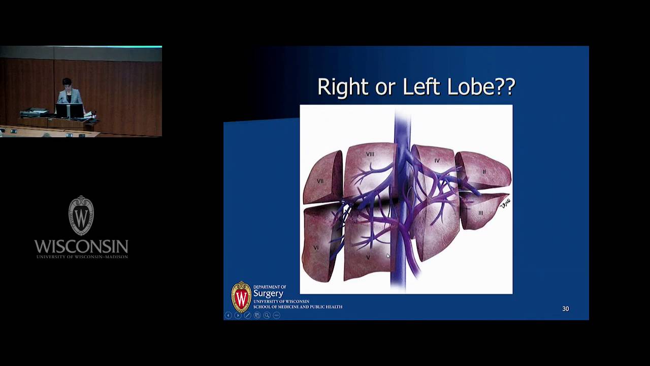 A Review on Living Donor Liver Transplantation