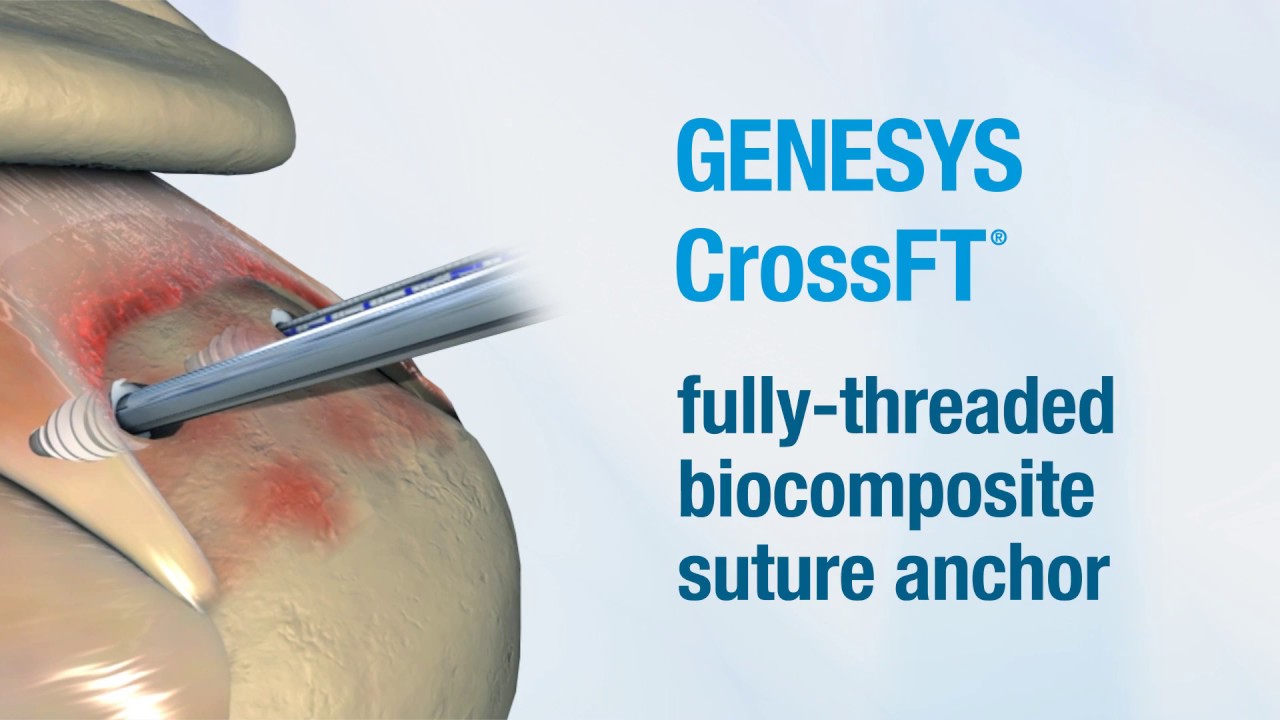 CONMED | GENESYS CrossFT® Anclajes de Sutura