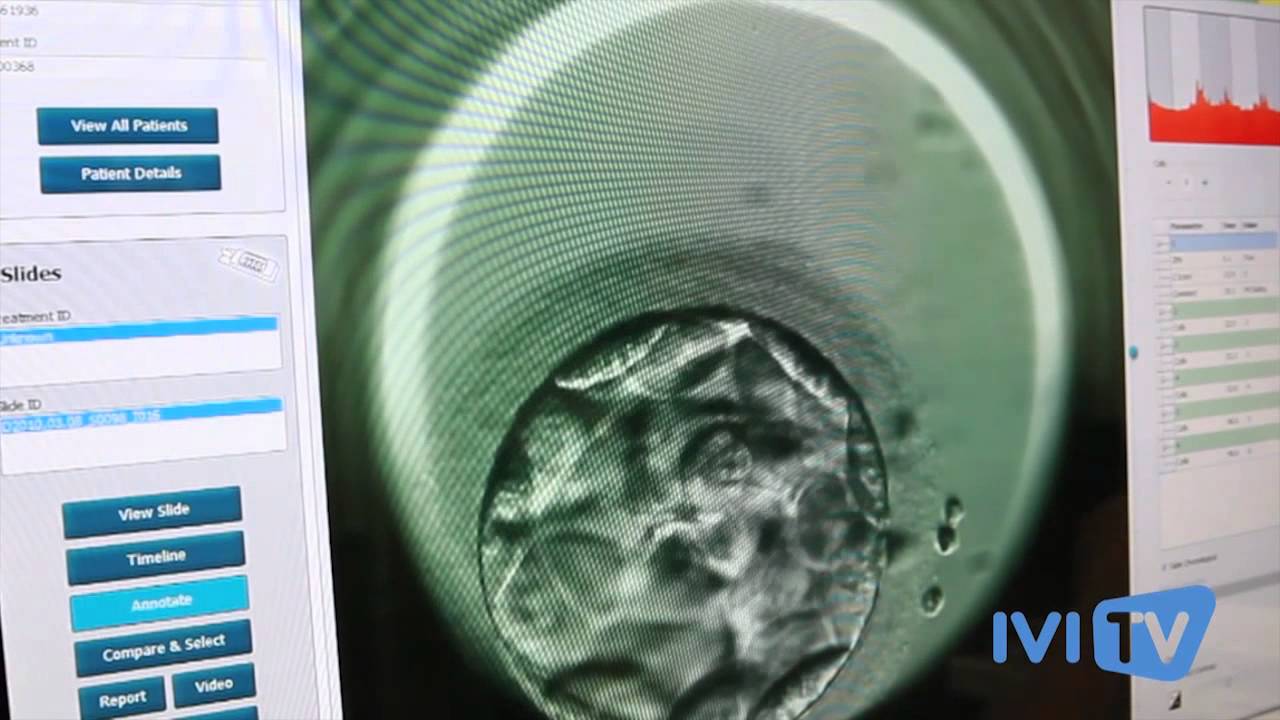 IVI Techniques Procreation Assistee - EMBRYOSCOPE (UE, 2014)