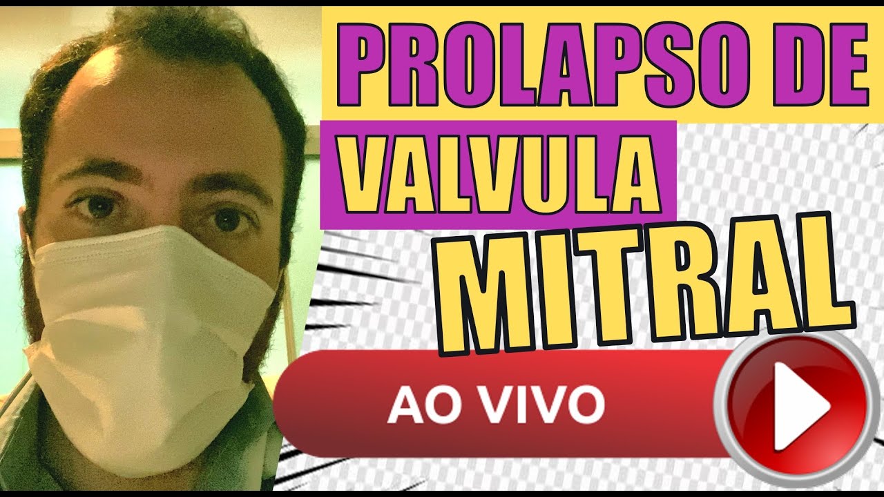 Veja um prolapso de valvula mitral como voce jamais iria imaginar!