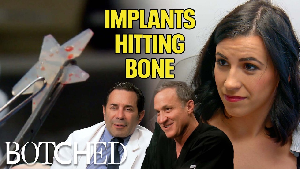 Ribcage Implants?! Ashlea's Extreme Body Mods Put Her Health At Risk (Before & After) | Botched | E!