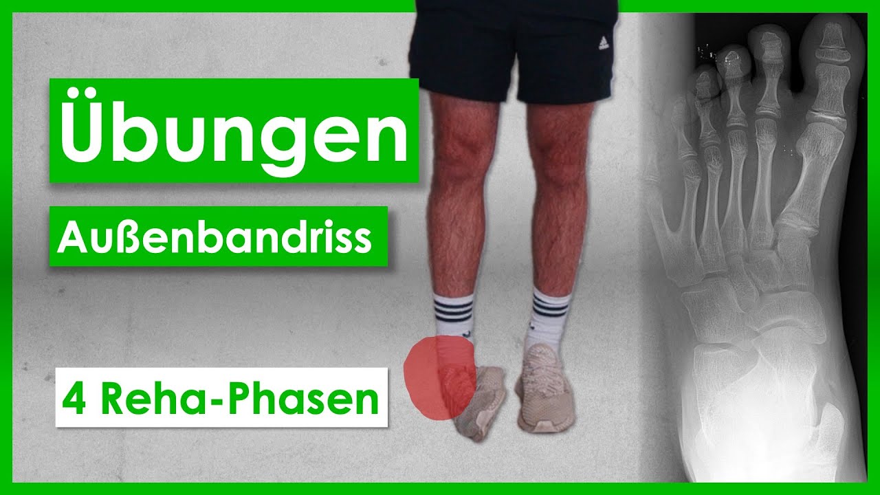 Bänderriss im Sprunggelenk⎮4 Phasen-Anleitung⎮Übungen