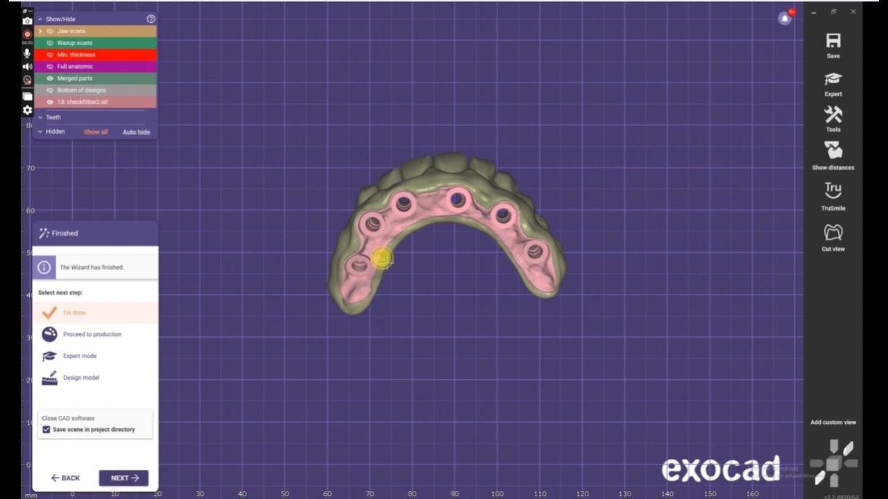 All steps how to design zirconia bridge on titanium Ibar in exocad