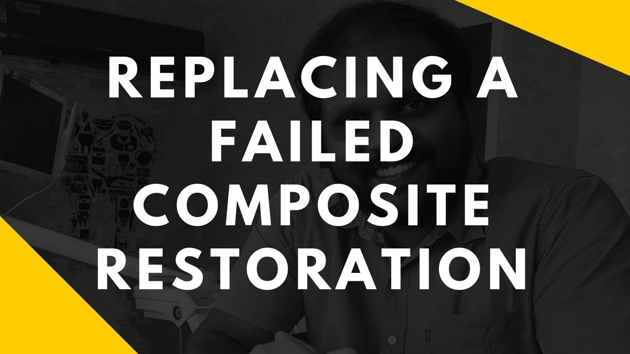 Replacing A Failed Composite Restoration - Dr. Rajeeve S Pillai