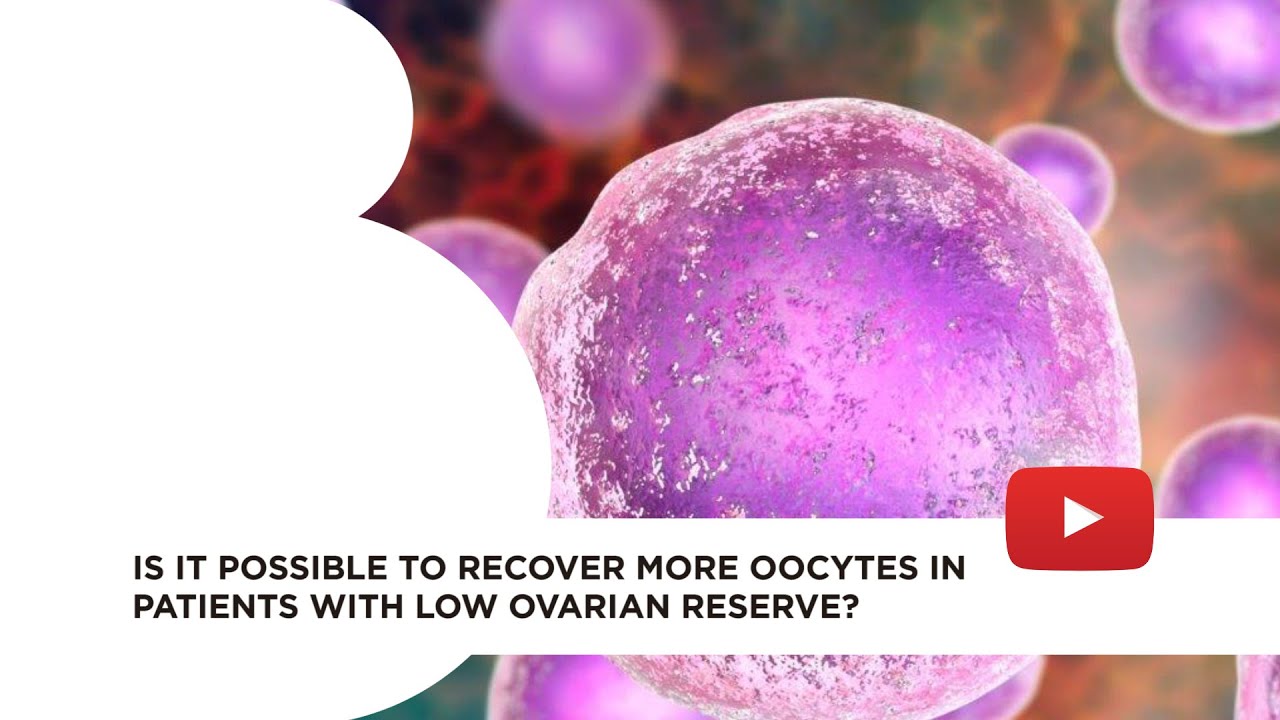 Oocytes double stimulation for patients with low ovarian reserve