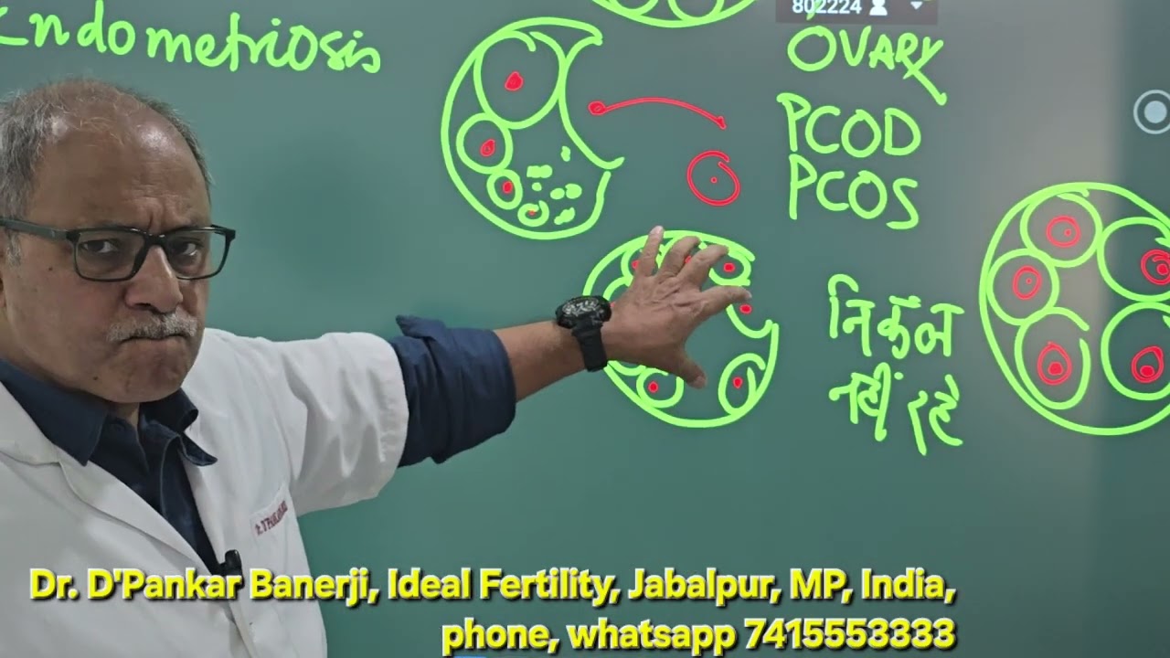 ओवरी में सिस्ट बताया गया है, क्या मैं IVF करा सकती हूं?