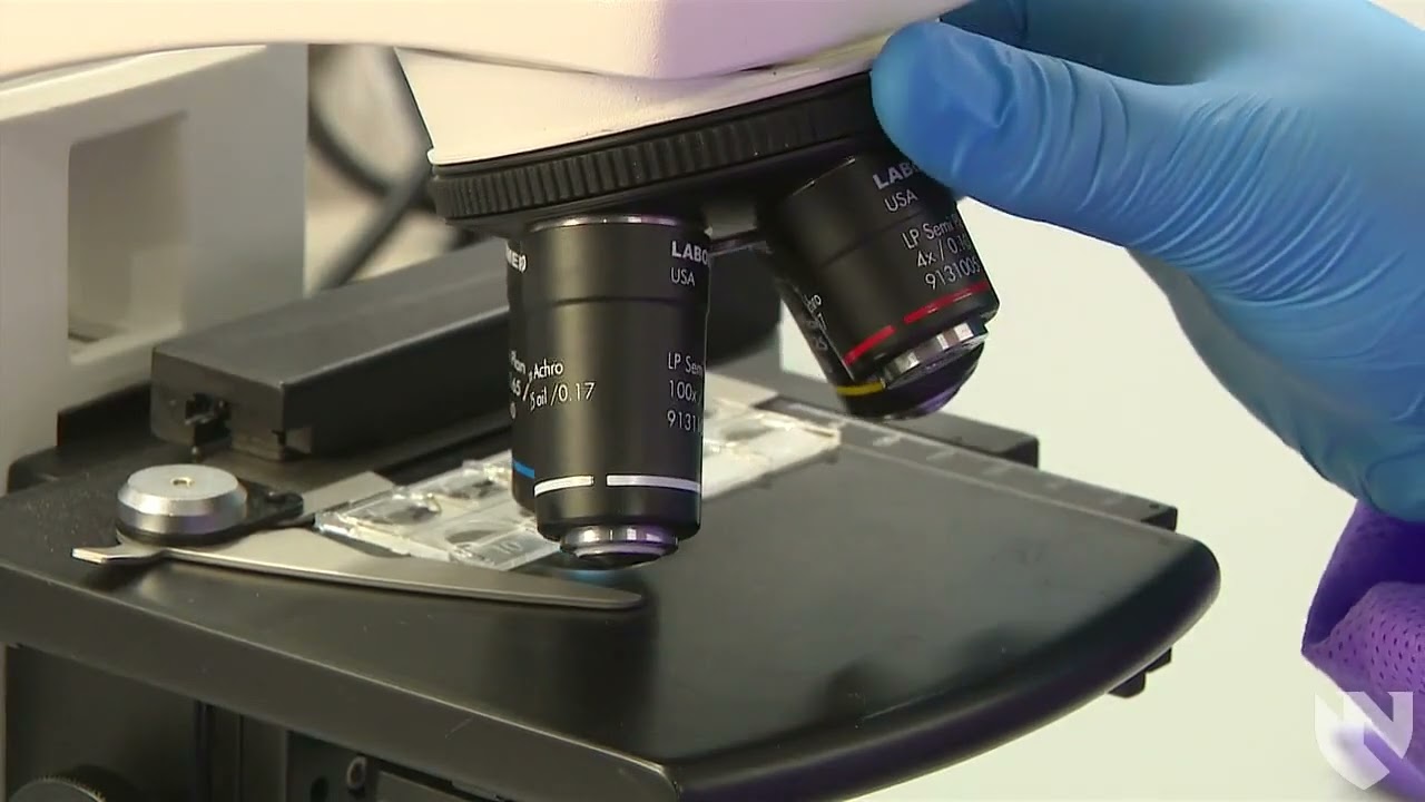 Urine Microscopic Exam
