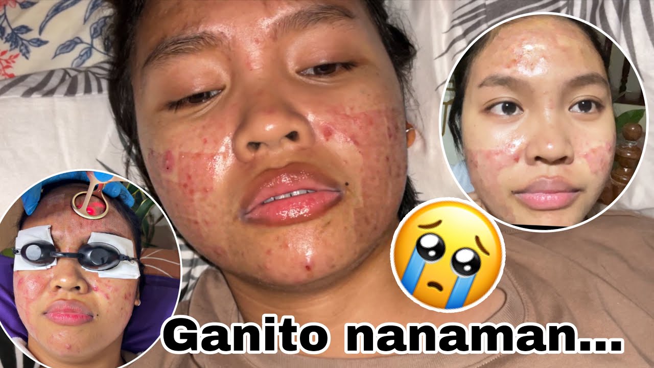 HIRAP NA AKO😭