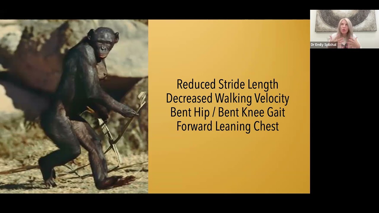 The Shaping of the Human Foot for Walking with Dr Emily Splichal