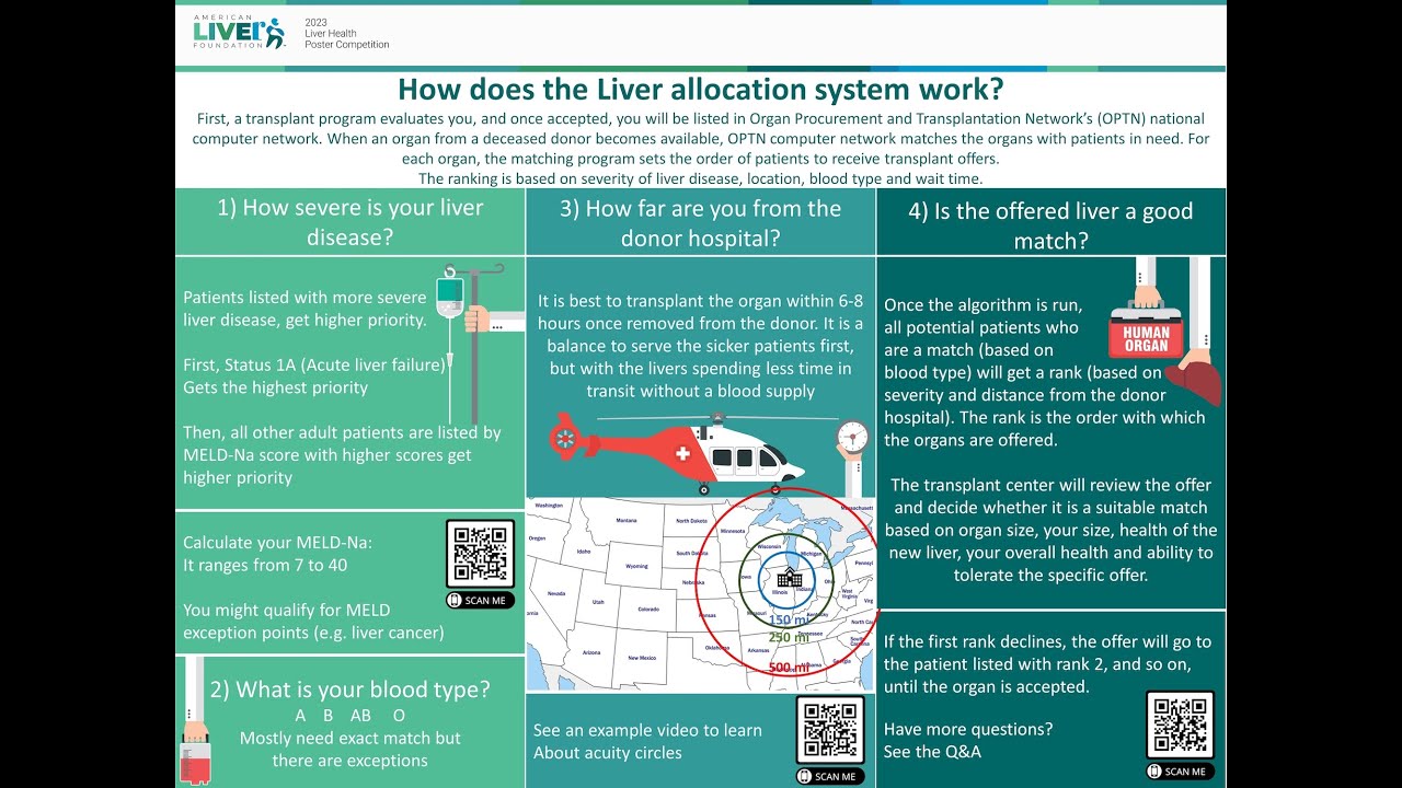 How does the liver allocation system work?, Anahita Rabiee, MD