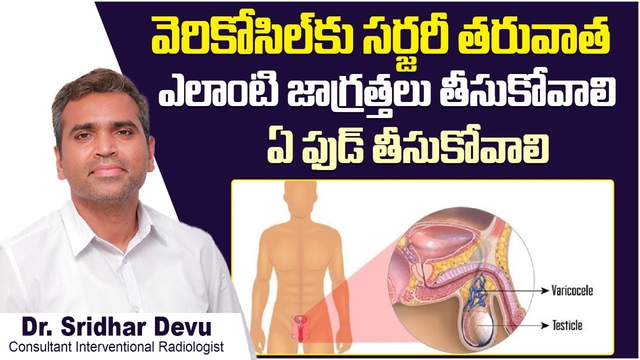 వెరికోసిల్ సర్జరీ తరువాత || Precautions to Take After Varicocele Embolization in Telugu || Dr Devu