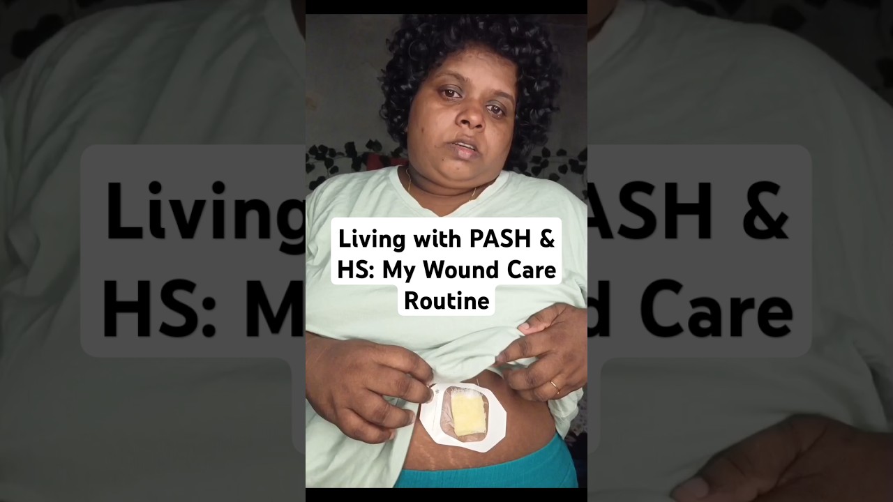 Living with Rare syndrome #shortsfeed #shortsvideo #shorts #painful #journey