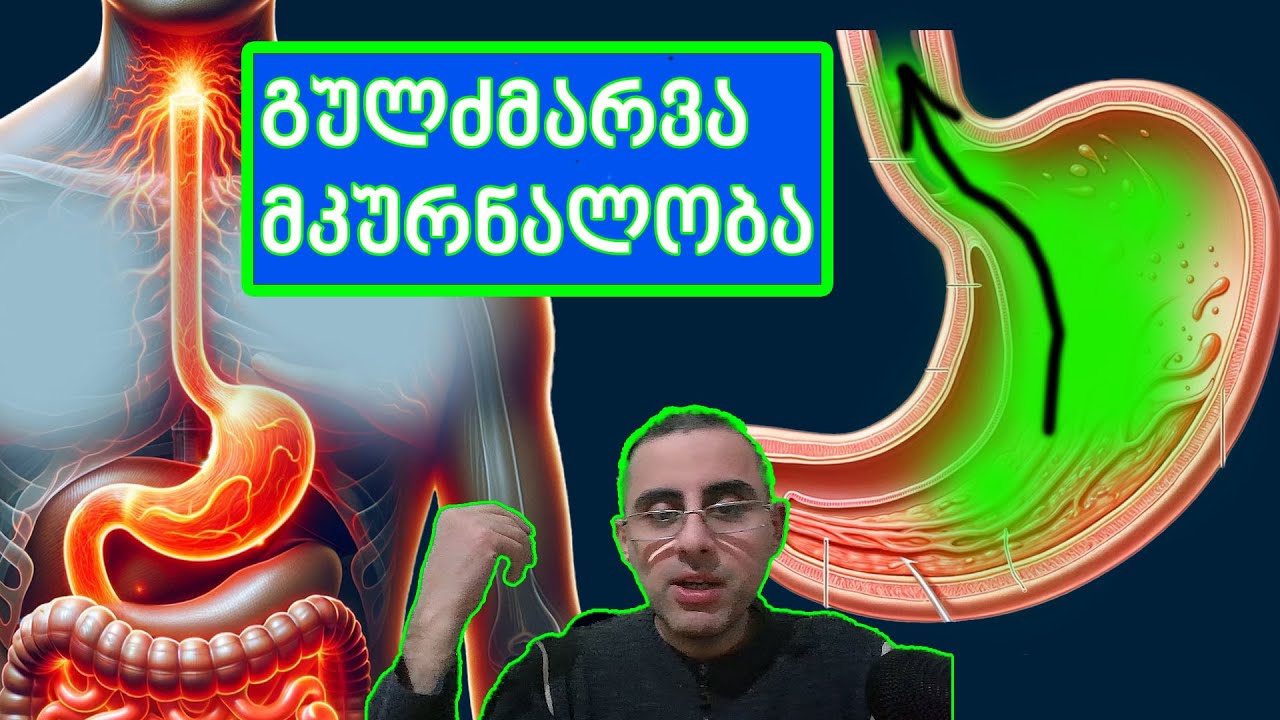 გულძმარვა - მკურნალობა.  გასტრო-ეზოფაგალური რეფლუხ დაავადება, საყლაპავის თიაქარი.