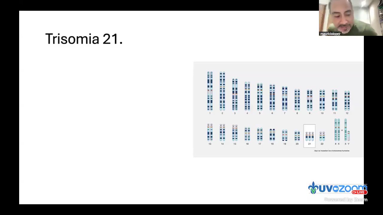 Ortopedia y Traumatología en el Síndrome de Down lo que toda familia debe saber | UV-310