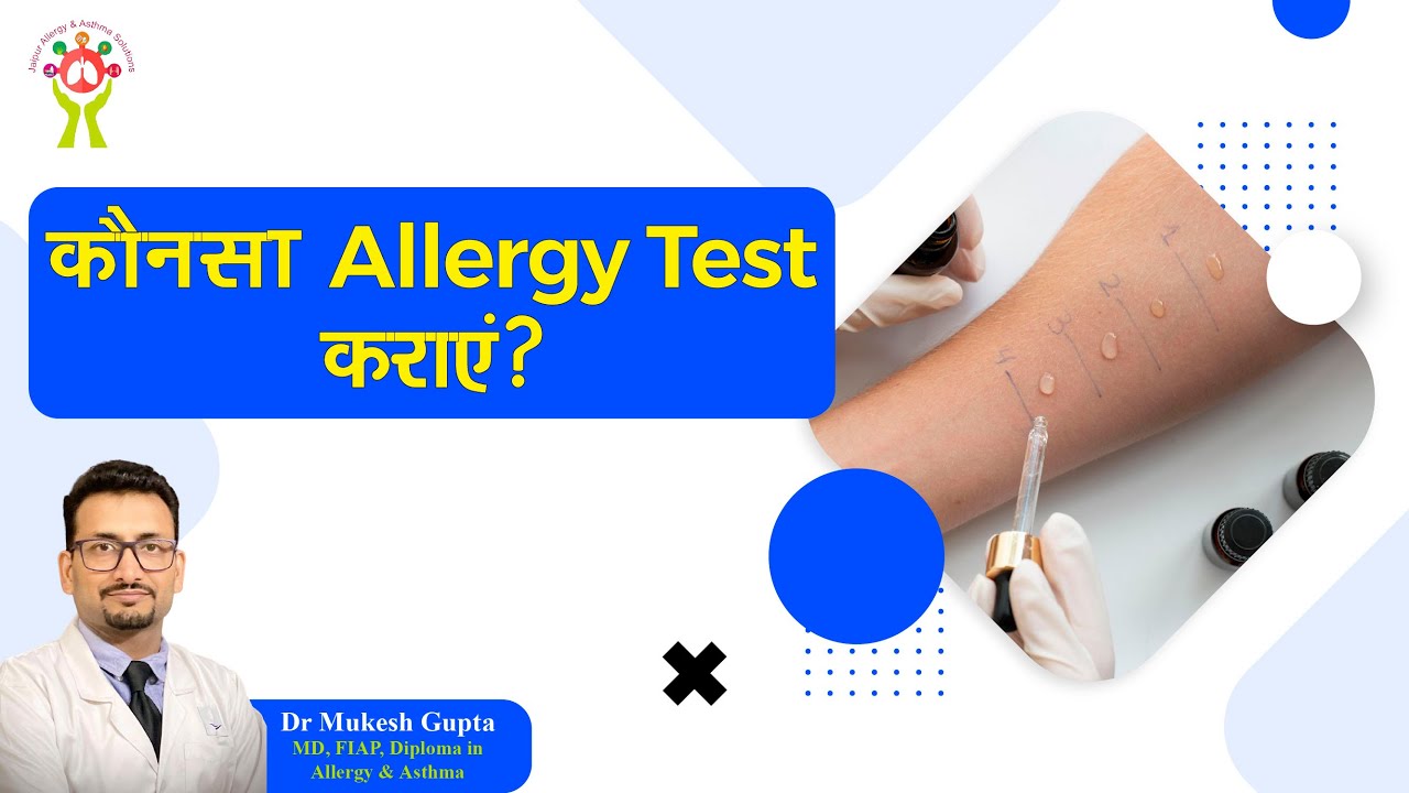 कोनसा एलर्जी टेस्ट कराएं? | Which allergy test to take? | Allergy Tests | MUST WATCH