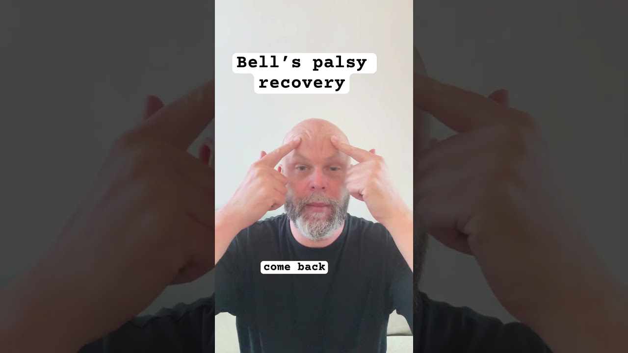 Bell’s palsy recovery with face massage