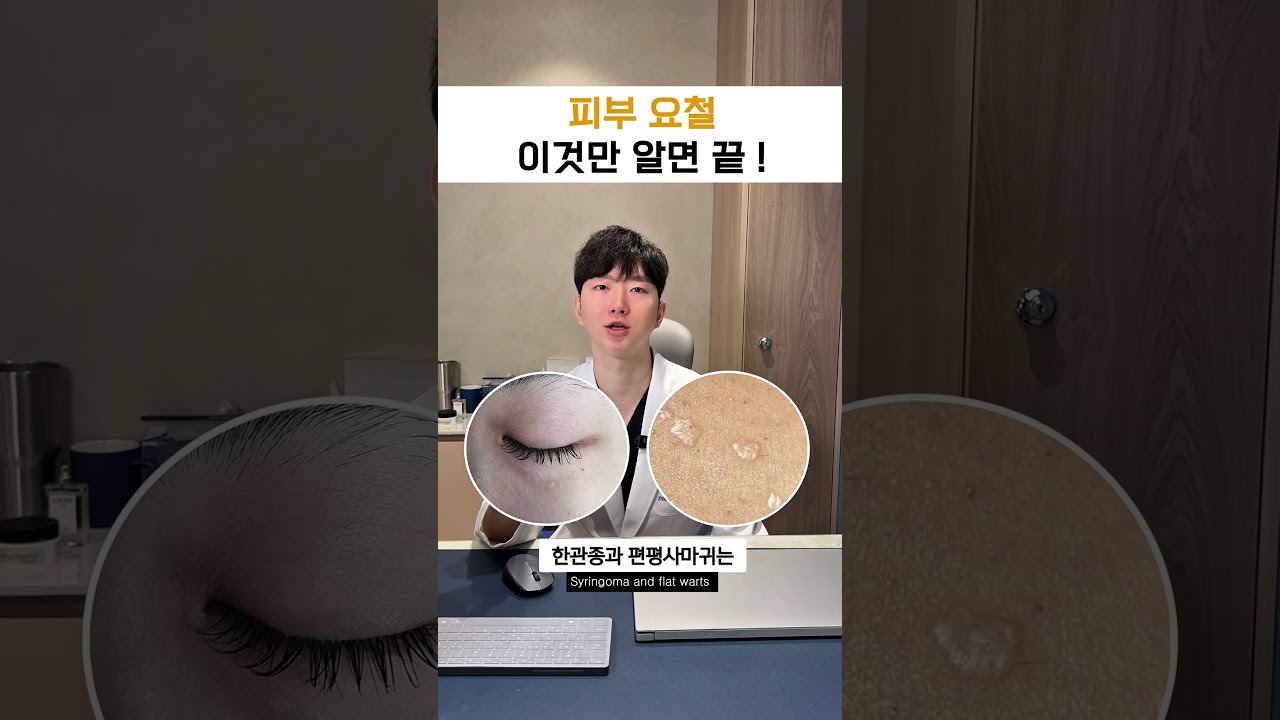 ✅얼굴에 오돌도돌 난 요철, 어떤 것이 있고 구별하는 방법은?🧑🏻&zwj;⚕️ #편평사마귀 #쥐젖 #비립종 #한관종 #피지선증식증 #화이트헤드 #여드름 #얼굴요철