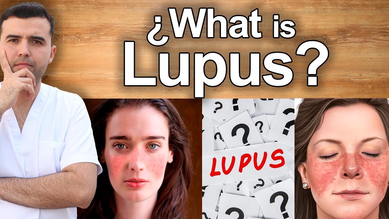 What is Lupus? - Learn More About This  Serious Auto-Immune Disease