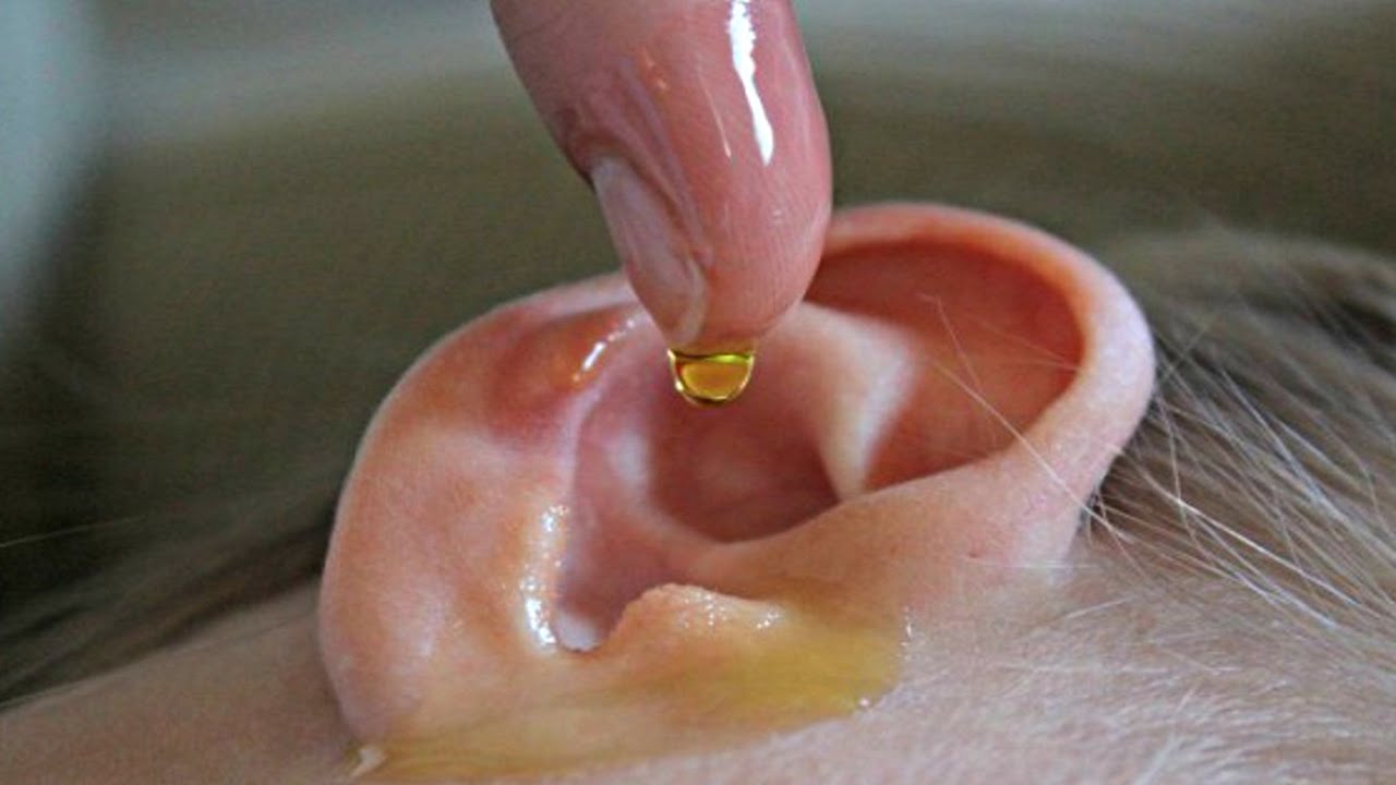 Natural Remedies for Ear Infection