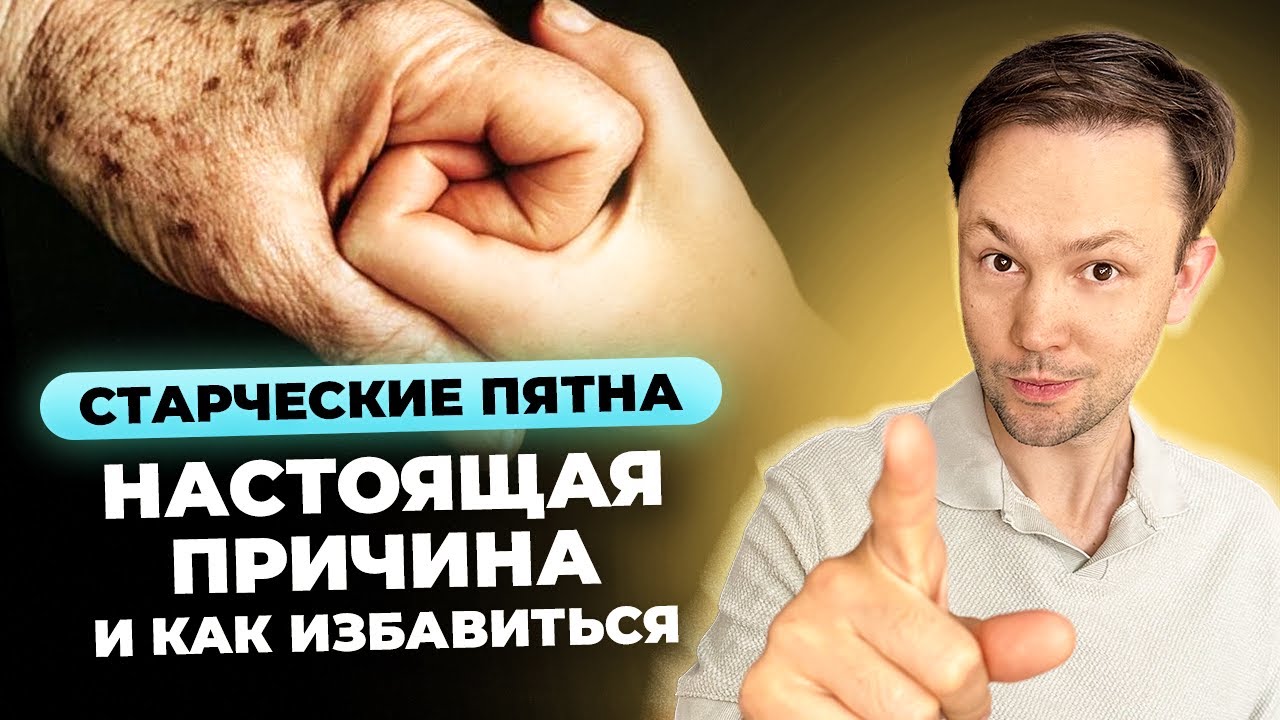 Пигментные пятна/Старческое лентиго. Как избавиться?