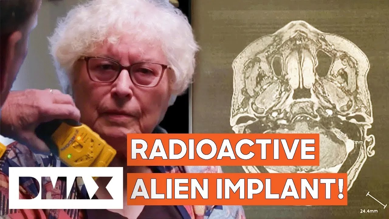 Radioactive Implants Inside Abductee Confirm Incredible UFO Encounter! | UFO Witness