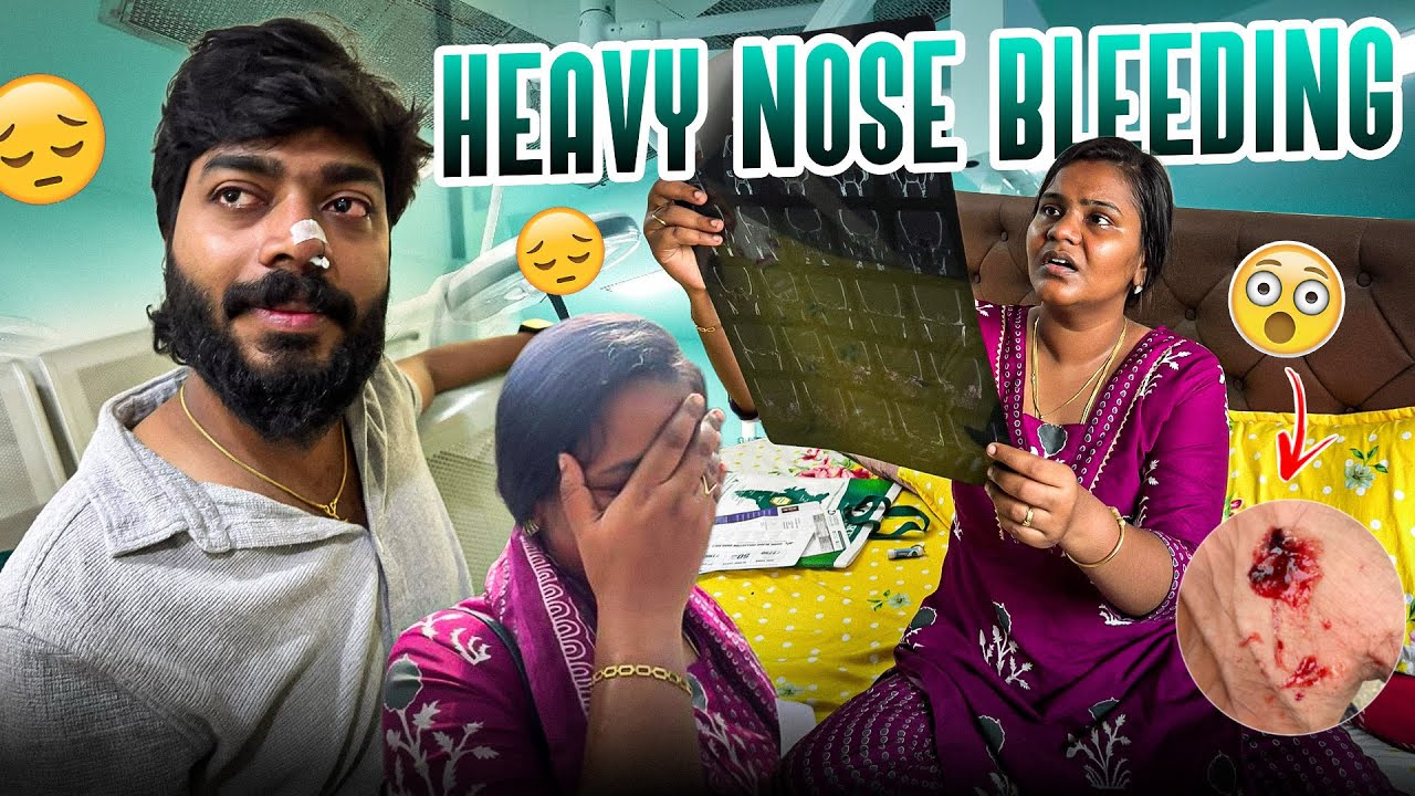 NOSE BLEEDING…?🩸We GOT SCARED…😭 | Allu Loves Priya 
