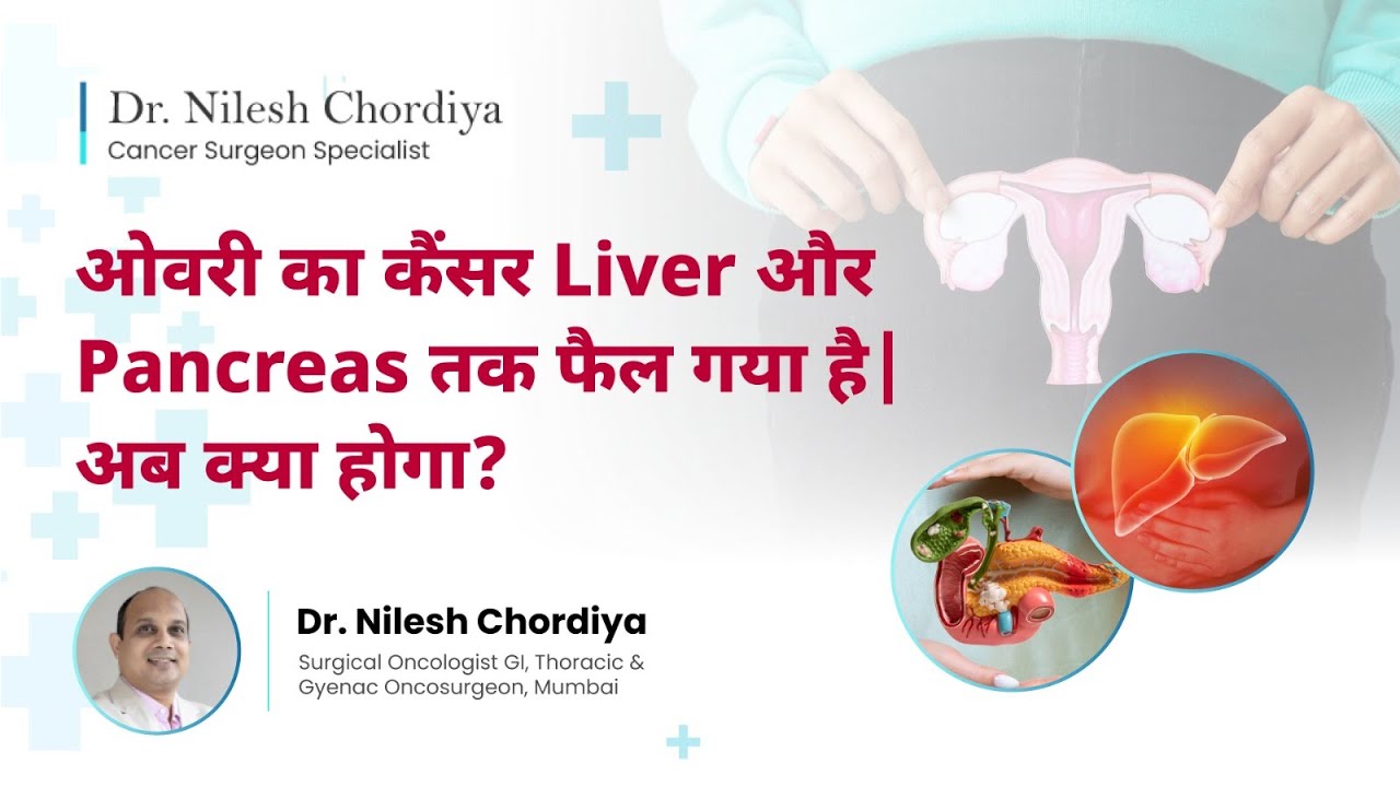 क्या Liver तक फैला हुआ Ovarian cancer Curable है? |Advanced Stage Ovarian Cancer| Dr Nilesh Chordiya