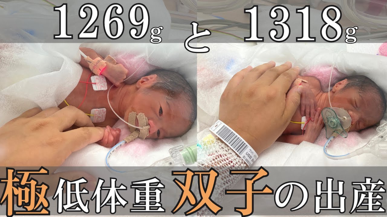 極低出生体重児「たち」が我が家に帰ってくるまで（Part1）