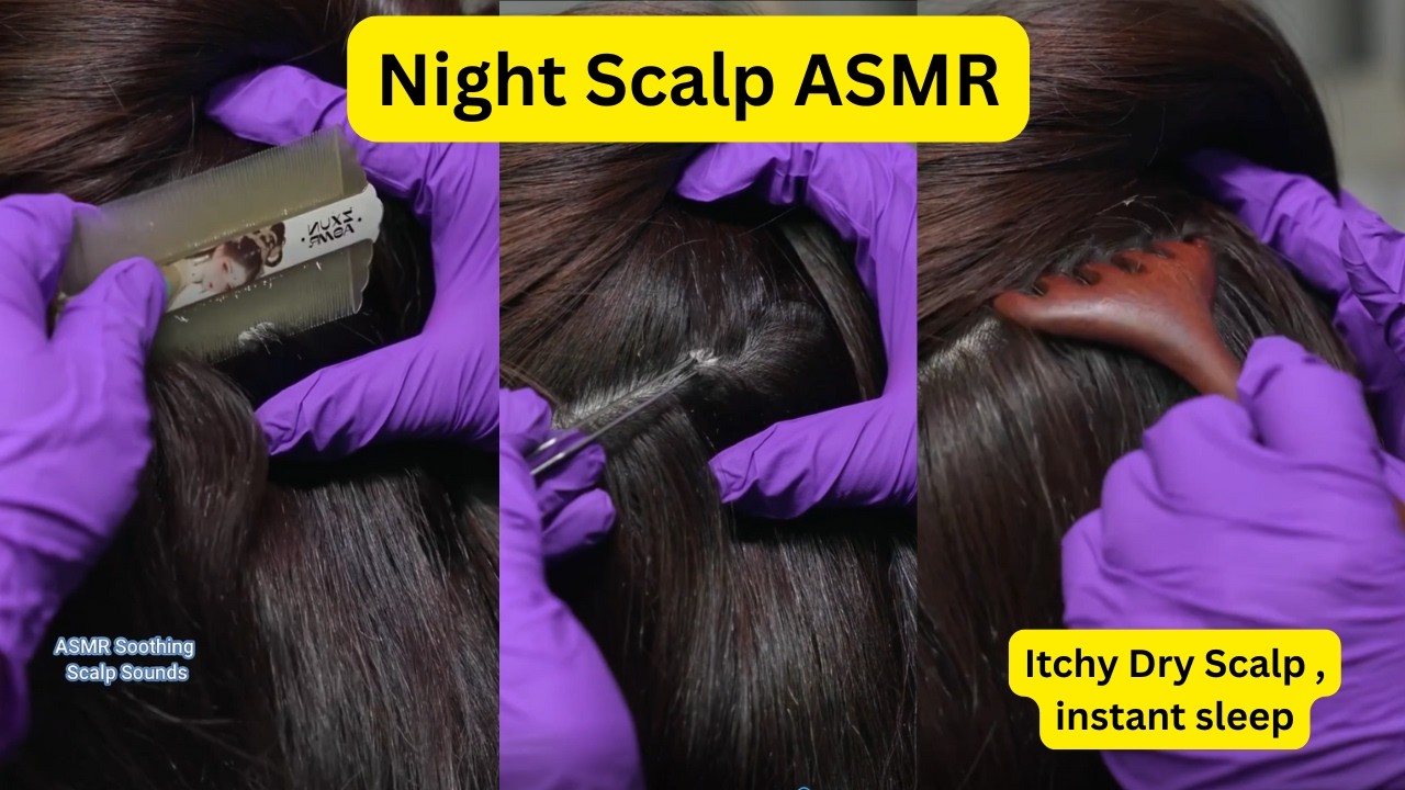 ASMR Dandruff Scratch Sounds #17